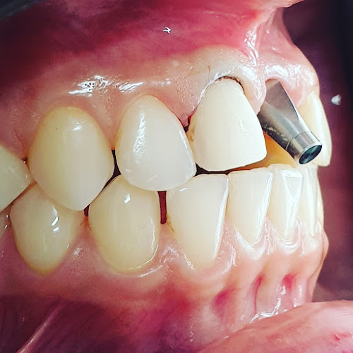 Implantologia Oral Dr. Aurélio da Costa Pires